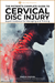 Cervical Disc Injury