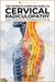 Cervical Radiculopathy
