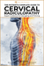 Cervical Radiculopathy