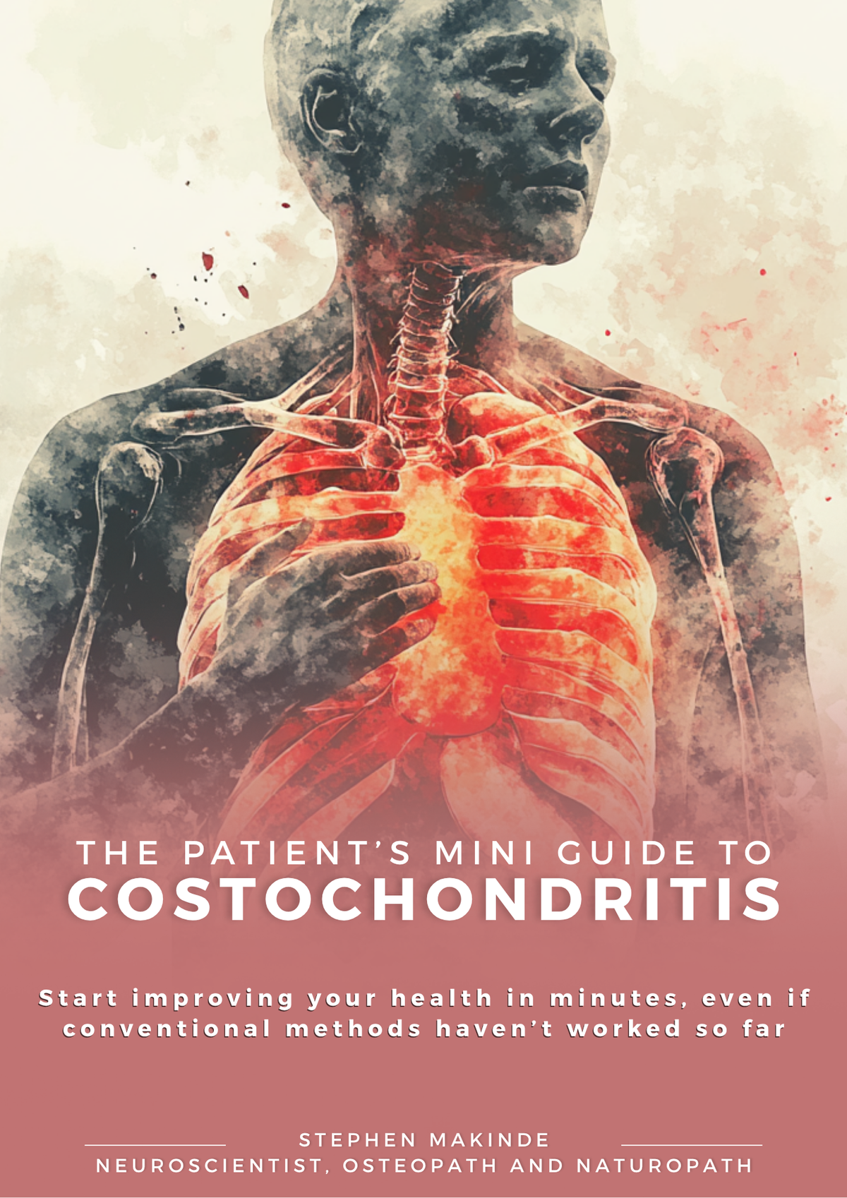 Costochondritis Treatment Guide