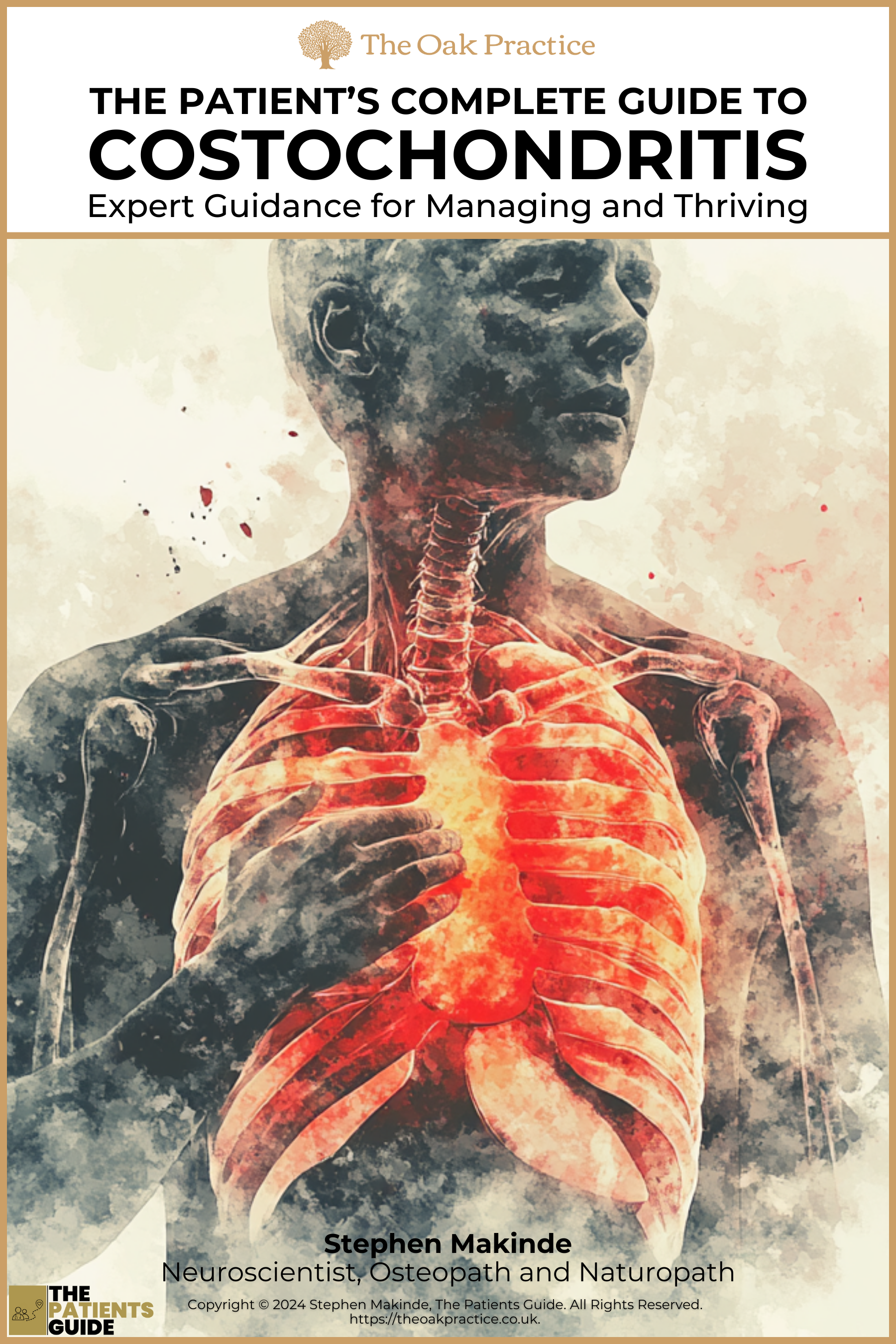 Costochondritis