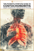 Costochondritis