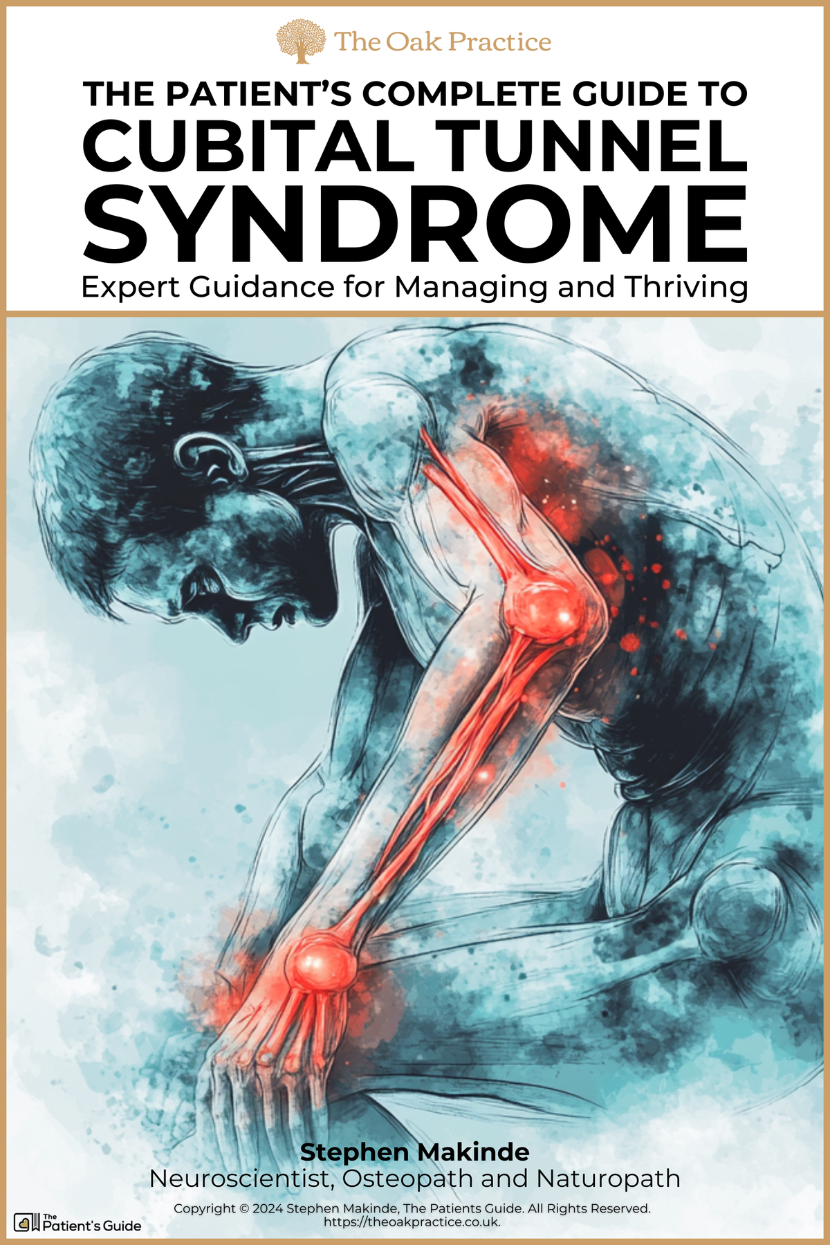 Cubital Tunnel Syndrome