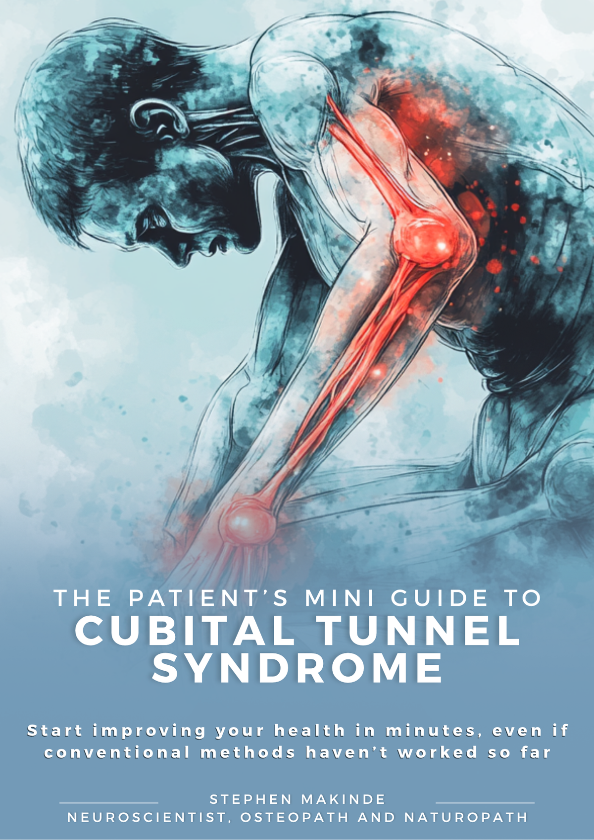 Cubital Tunnel Syndrome Treatment Guide