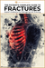 Fractures