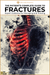 Fractures
