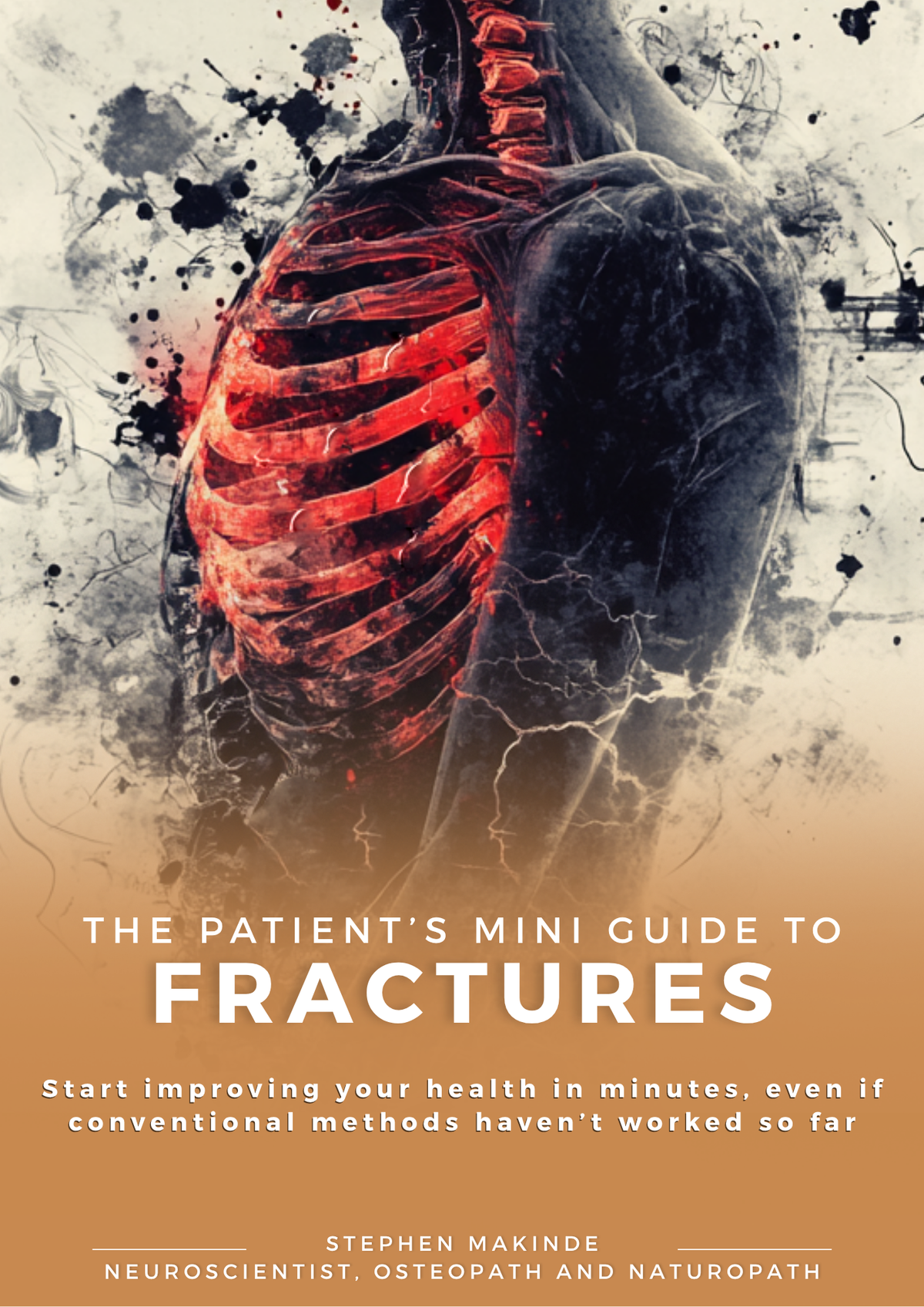 Fractures Treatment Guide