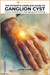 Ganglion Cyst