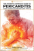 Pericarditis